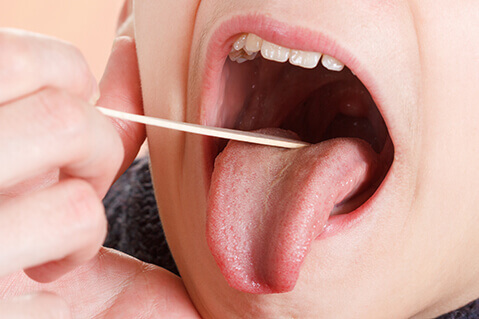 Tongue depressor in mouth